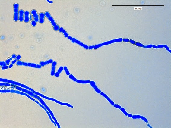 Fun With Microbiology Whats Buggin You Aureobasidium Pullans