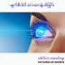မ်က္စိပါဝါ ေလဆာနဲ႔ပစ္ျခင္း 