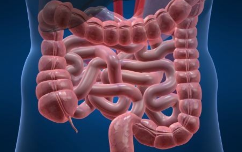 Usus Sehat Jauh Dari Stroke