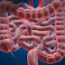 Usus Sehat Jauh Dari Stroke, Para Peneliti Temukan Bakteri di Usus Pemicu Stroke
