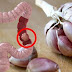 50% of ALL Colon Cancer Cases Could Be Prevented if Everybody Did THESE 9 Things