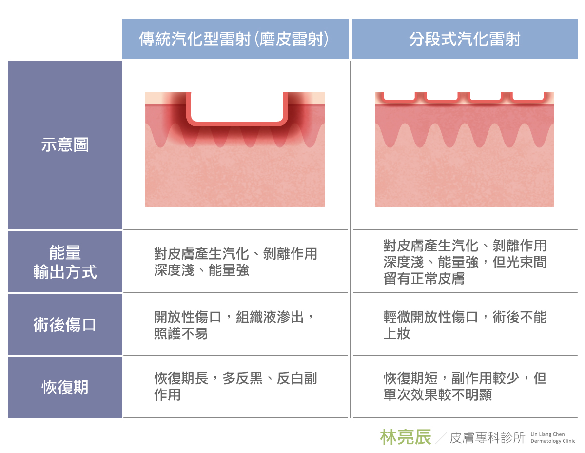 PicoSure755皮秒雷射蜂巢式聚焦陣列透鏡蜂巢皮秒雷射雀斑痘疤毛孔細紋新竹推薦林亮辰皮膚專科診所林亮辰醫師UP雷射UltraPulse痘疤凹疤痘疤淡化凹疤修復凹疤ptt凹洞治療費 PicoSure755皮秒雷射蜂巢式聚焦陣列透鏡蜂巢皮秒雷射雀斑痘疤毛孔細紋新竹推薦林亮辰皮膚專科診所林亮辰醫師UP雷射UltraPulse痘疤凹疤痘疤淡化凹疤修復凹疤ptt凹洞治療費