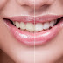 The limits Of Tooth Whitening