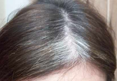 VLOPY SEO ARTICLE: Cara Mengobati Uban Rambut secara ...