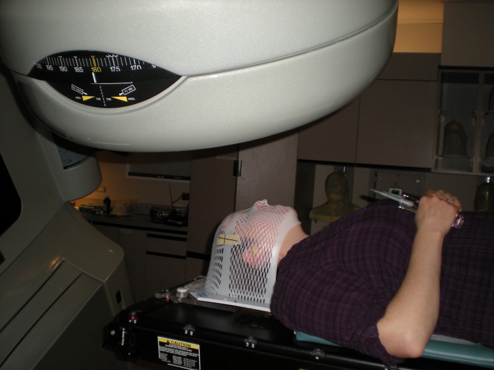 Surviving Brain Cancer; The Story of Tamara Meza My Radiation Mask