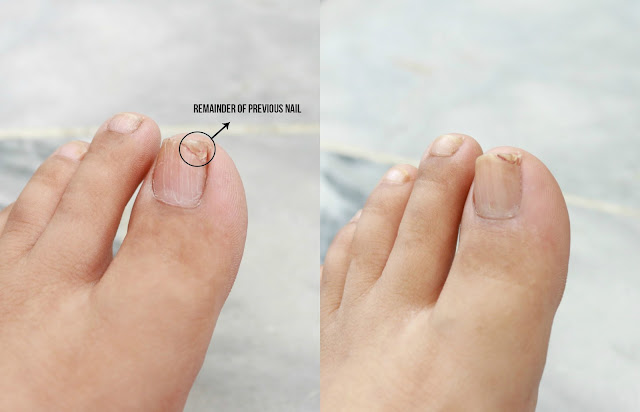 OPI Nail Envy Nail Strengthener Matte Formula Before and After OPI Nail Envy Nail Strengthener Matte Formula Before and After