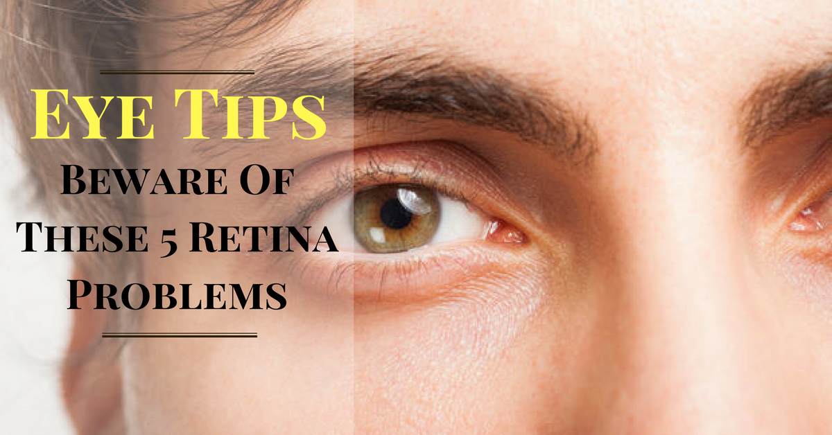 Eye Tips Beware Of These 5 Retina Problems Sharp Sight Centre