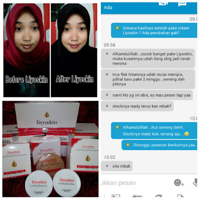 Cream Penghilang Bintik Hitam Di Hidung Dan Dahi Liyoskin Cream Penghilang Bintik Hitam Di Hidung Dan Dahi