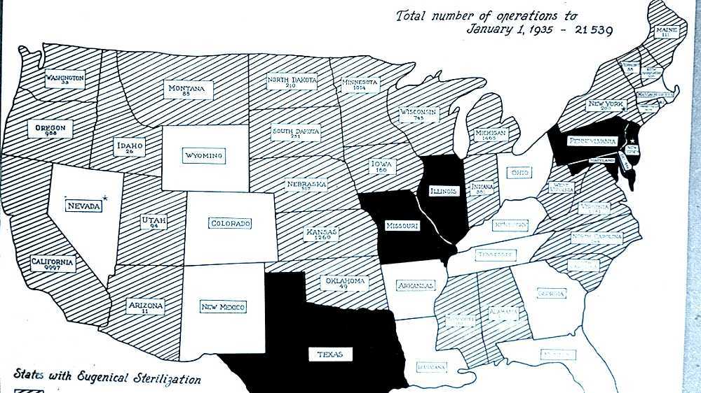 Sterilization law in the United States