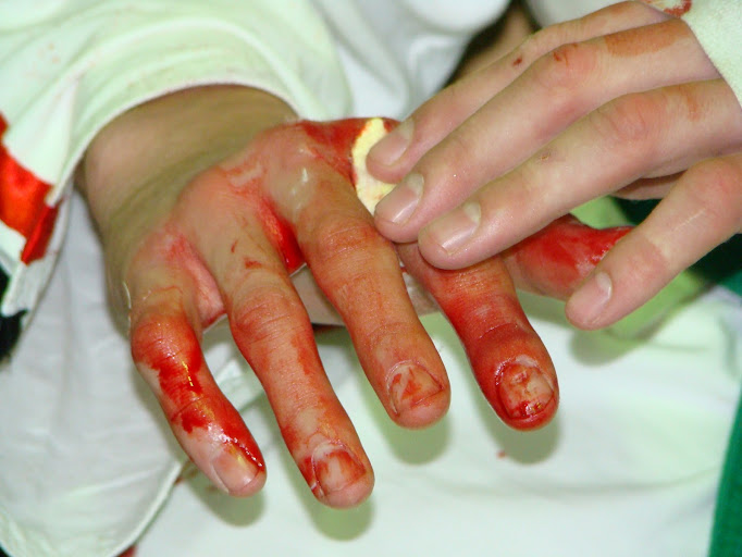 Кубок области по Карате, Жигулевск