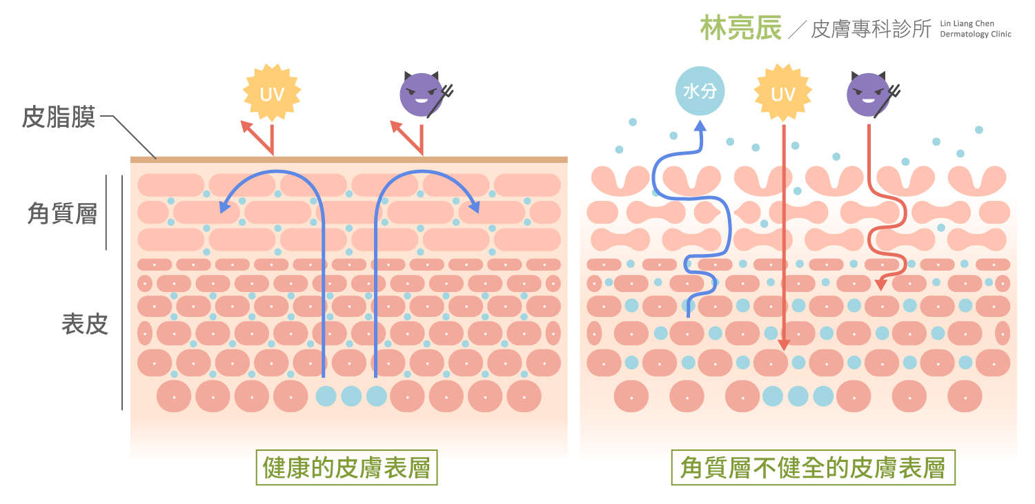 PicoSure755皮秒雷射蜂巢式聚焦陣列透鏡蜂巢透鏡皮秒雷射蜂巢皮秒雷射換季過敏酒糟肌皮膚過敏皮膚問題全方位皮膚照護皮秒雷射推薦林亮辰皮膚專科診所林亮辰醫師