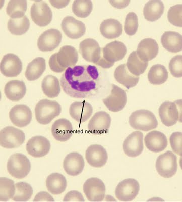 InfoSemata: Jenis jenis Leukosit Jenis jenis Leukosit | InfoSemata
