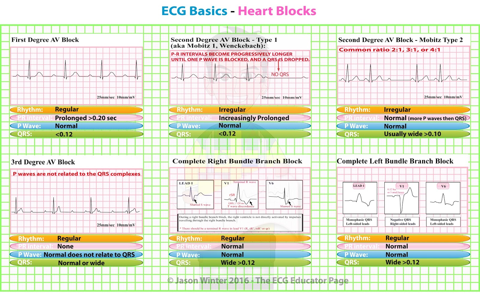 does complete hrt block have an ivcd