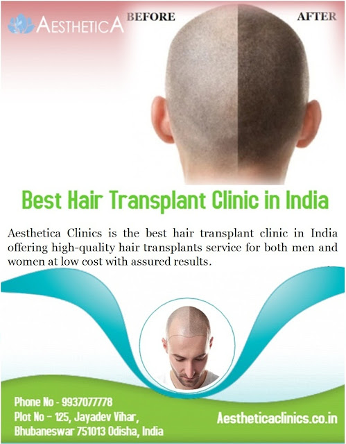 hair transplant strategy