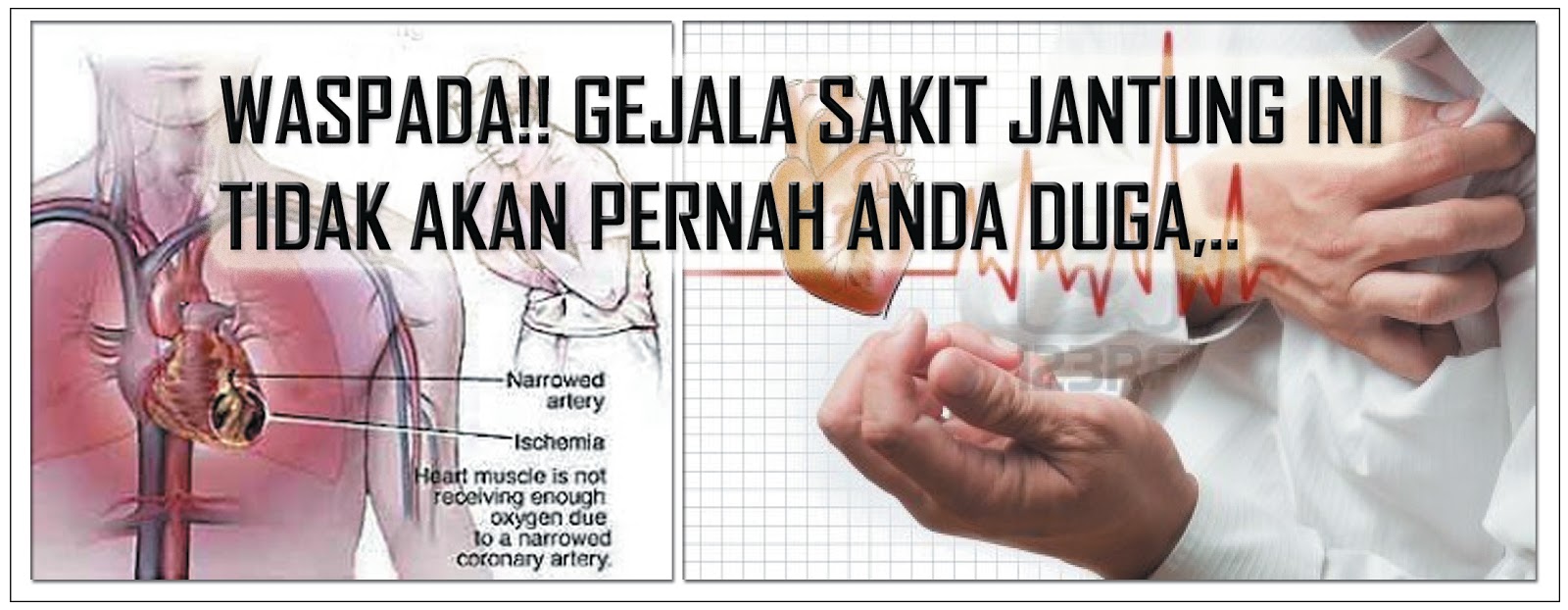 Tanda tanda Sakit Jantung Cara Mencegah Dan Merawat Sakit Tanda tanda Sakit Jantung Cara Mencegah Dan Merawat Sakit