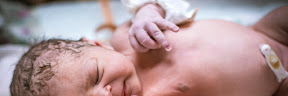 Penyakit Sistinosis Pada Bayi Yang Baru Lahir