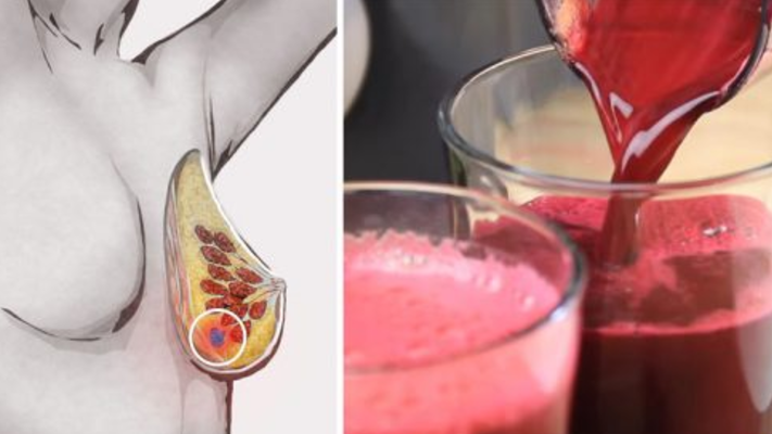 6 Reasons Why You Should Drink Beet Juice Every Day!