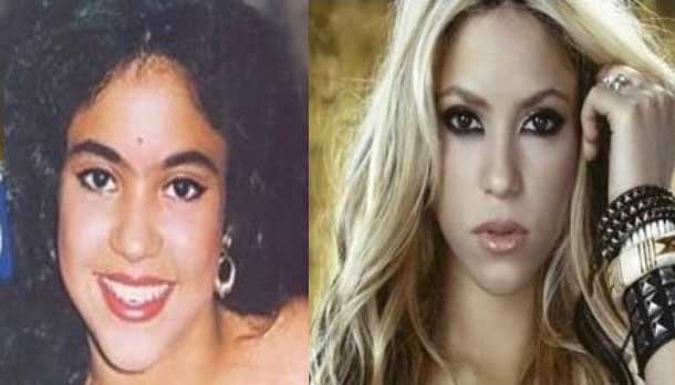 Shakira Plastic Surgery