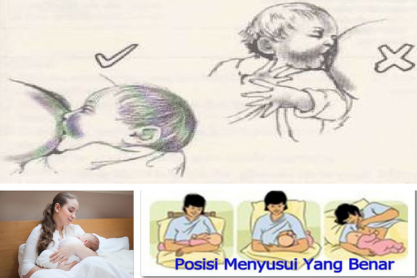 3 Kesalahan Umum Saat Menyusui yang Membuat Bayi Tersedak. Hindari Moms 3 Kesalahan Umum Saat Menyusui yang Membuat Bayi Tersedak. Hindari Moms