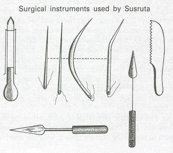 Ancient India Surgery Test Plastangel