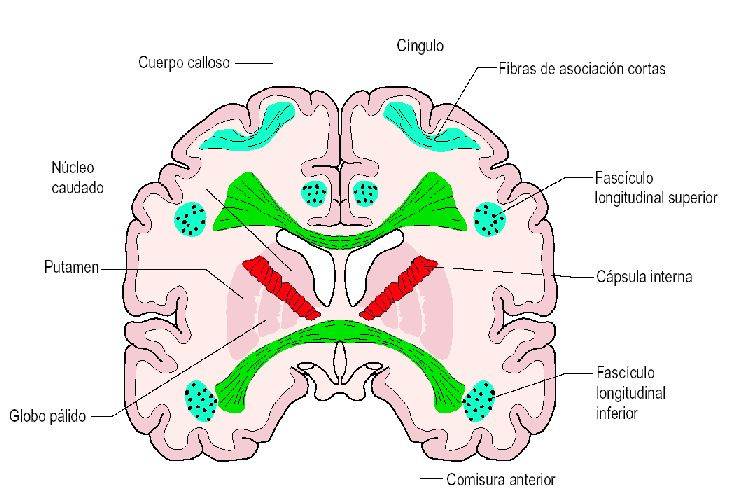Cerebro izquierdo cápsula interna Cerebro izquierdo cápsula interna