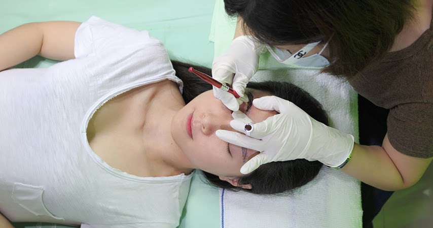 Agar Sulam Alis Cepat Mengelupas Informasi Dunia Kesehatan