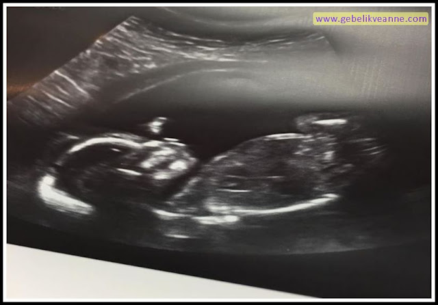 17 Haftalık Gebelik (Hamilelik) Ultrason Görüntüleri