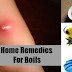 Home Remedies for Boils that Really Work | How To Get Rid Of A Boil Fast Naturally At Home