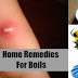 Home Remedies for Boils that Really Work | How To Get Rid Of A Boil Fast Naturally At Home