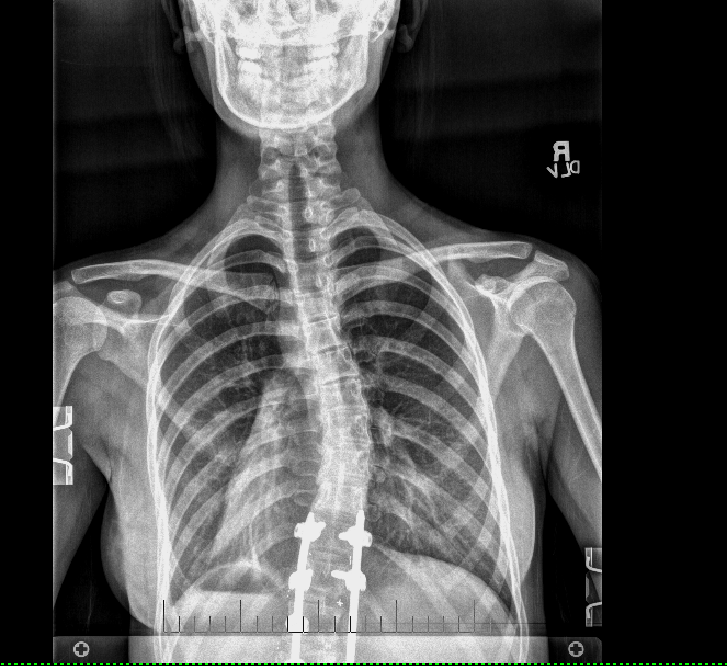 spine align chirobedic spine align chirobedic