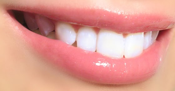 Cara Mengatasi Sakit Gigi dengan Mudah  Kesehatan96