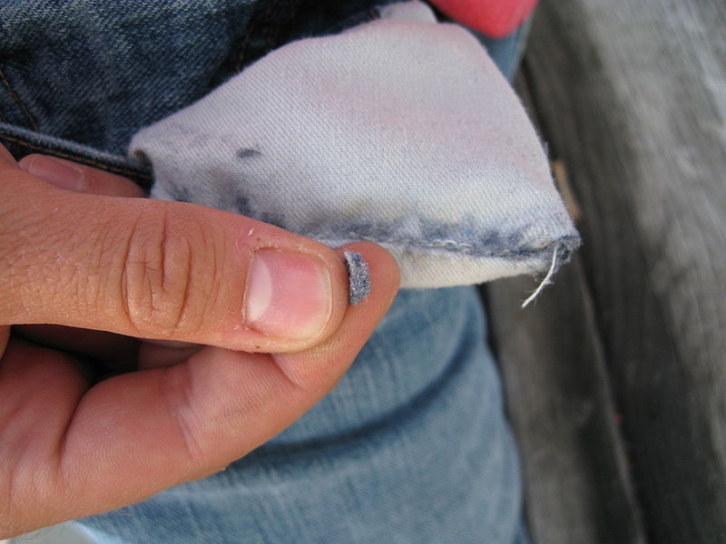 Kirkepiscatoid The patient