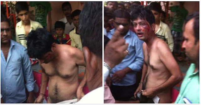 TRAGIS !! Empat insiden tragis pria tewas akibat kehilangan penis TRAGIS !! Empat insiden tragis pria tewas akibat kehilangan penis