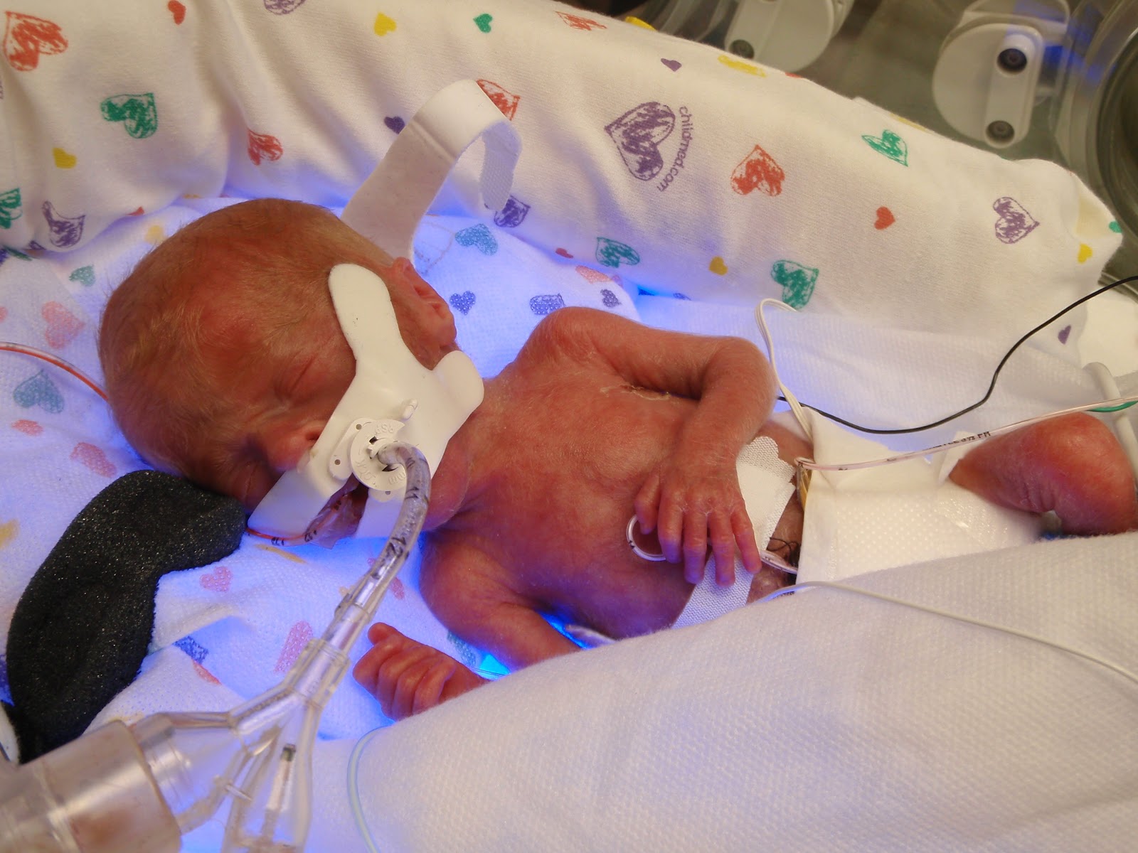 connor-twins-26-weeks-old-today