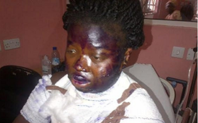 hot water attack lagos nigeria hot water attack lagos nigeria