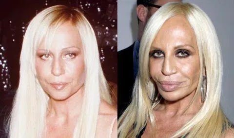 Before And After Celebs Plastic Surgery Disasters Before And After Celebs Plastic Surgery Disasters