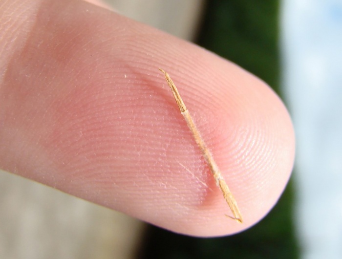 SHE PUTS AN ONION IN HER EAR. THE REASON WHY IS A FASCINATING TRICK