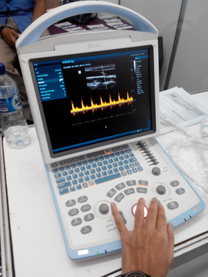 Distributor Alat USG Paling Bagus Mindray Dp 10 Doppler Distributor-alat-usg-payudara-mindray-dp-10-doppler