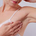 5 dicas para eliminar manchas nas axilas