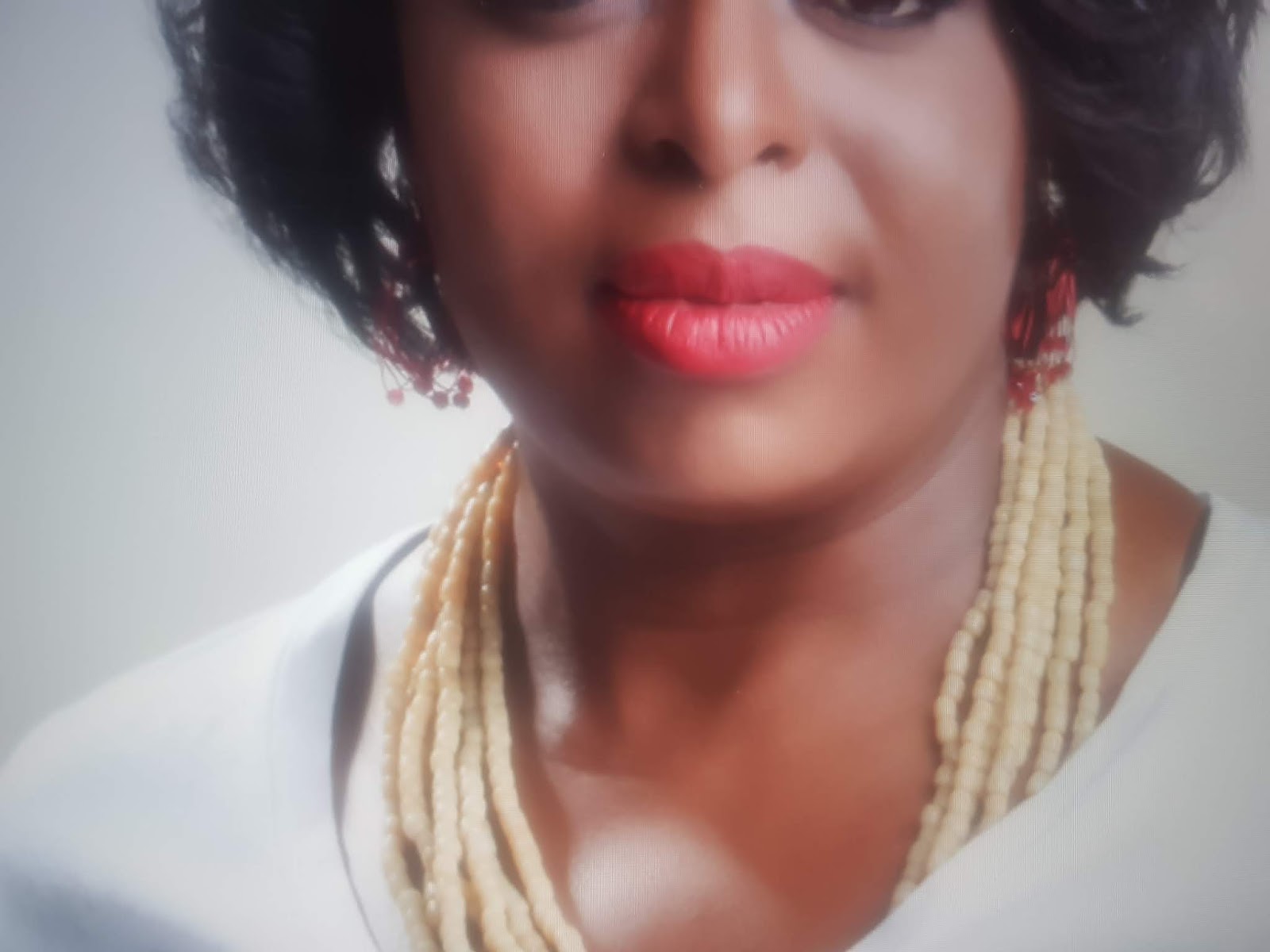 labioplasti ameliyati nedir