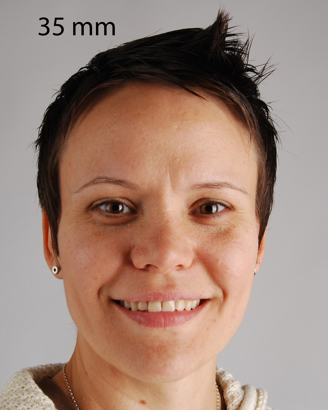 digital dental photo blog Macro Lens = Portrait Lens