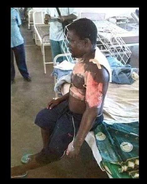 Charity Gomba: WOMAN SETS HER SISTER AND HUSBAND ON FIRE AFTER SHE ...