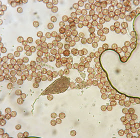 Spores of violet Fuligo septica showing oil droplets