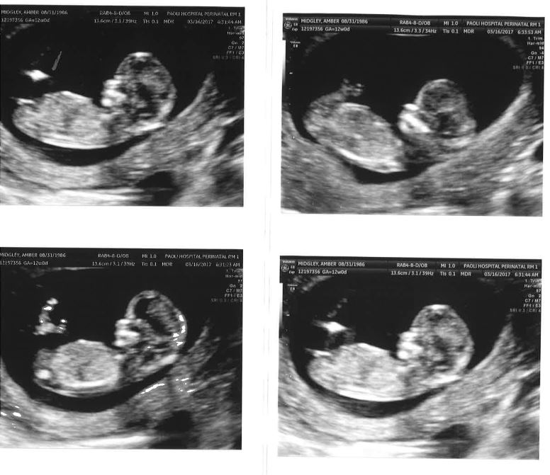 Busy, Bold, Blessed First Trimester Recap