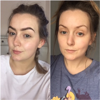 skinkissed serum amazon