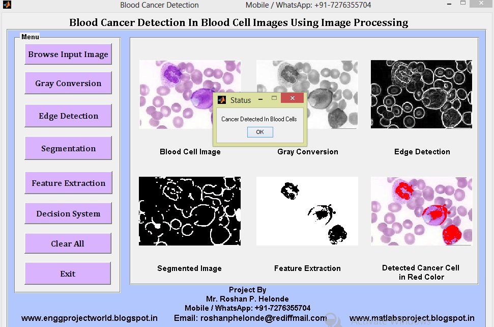 Leukemia Blood Cancer Detection Using Image Processing Matlab Project