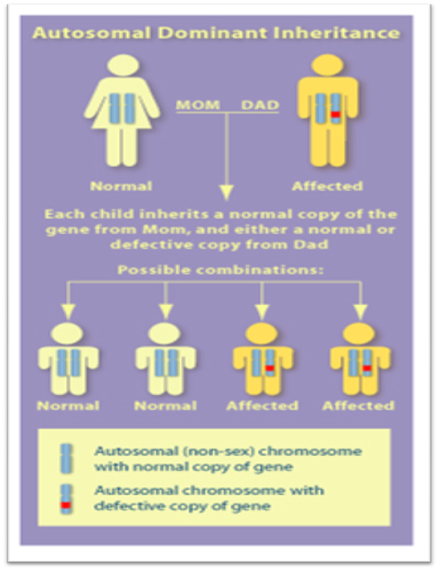 Example of Autosomal Dominant Disorders Huntington's disease