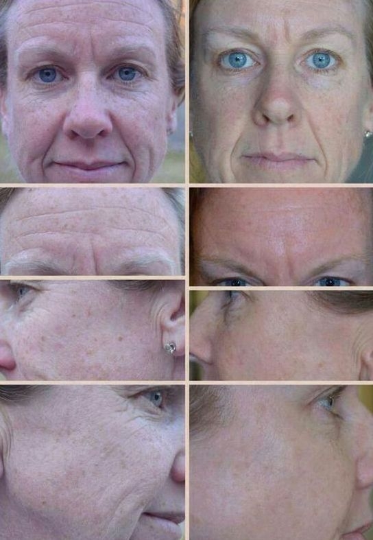 Facial Exercises For Face Toning And Firming