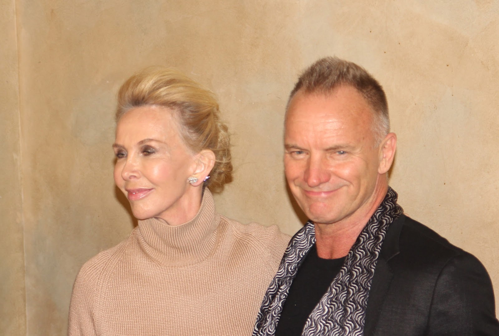 Trudie Styler Plastic Surgery The Truth Behind The Transformation