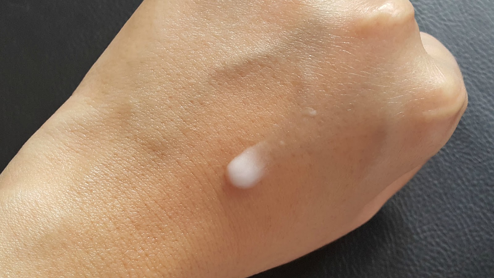 EM BANDRANG My Epiduo Journey EPIDUO ANTI ACNE GEL Review